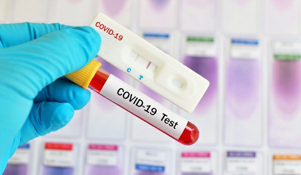 Farmácias poderão aplicar testes para covid-19